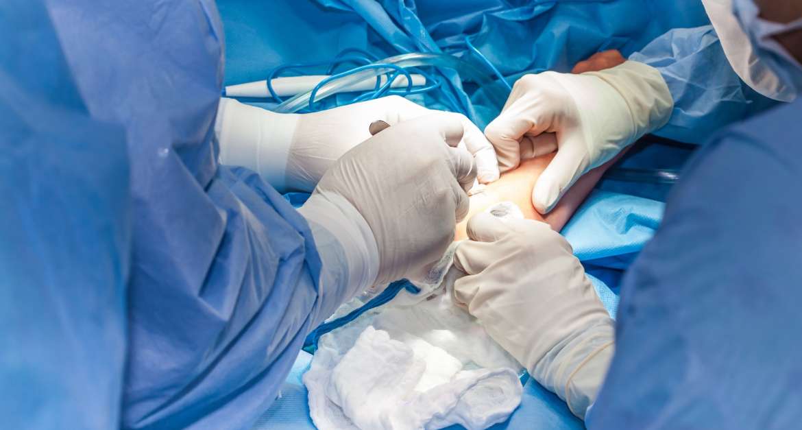 Offene Eingriffe am Ellenbogen in München - Durchgeführt von Prof. Dr. med. Martetschläger