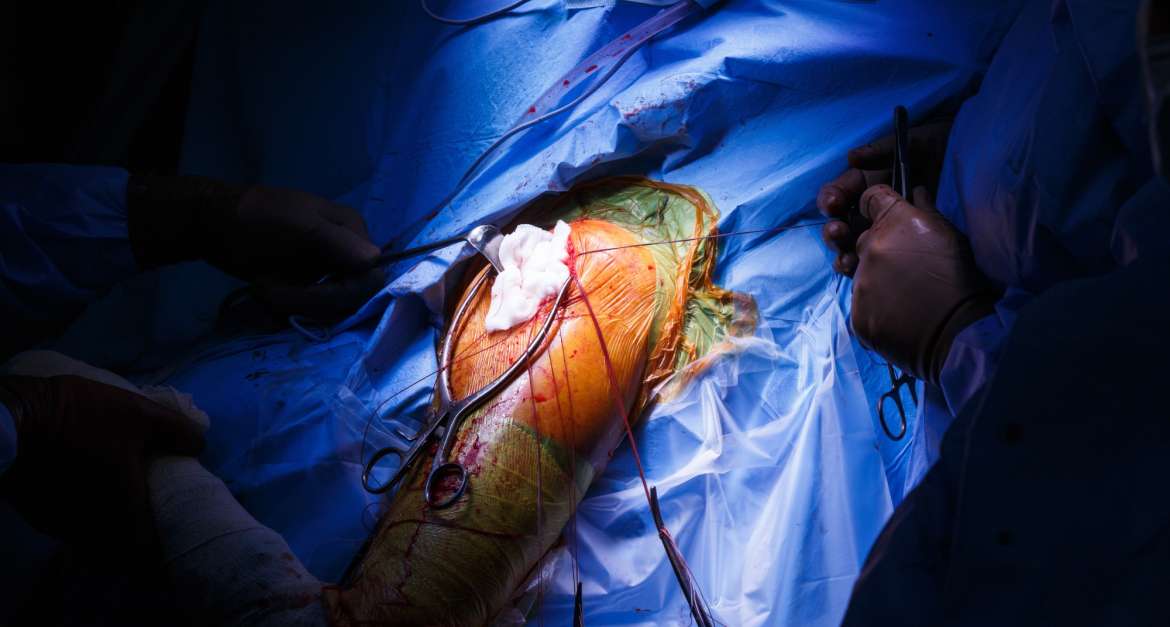 Offene und minimalinvasive Operationen an der Schulter in München - Durchgeführt von Prof. Dr. med. Martetschläger